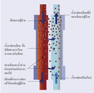 โรคไต